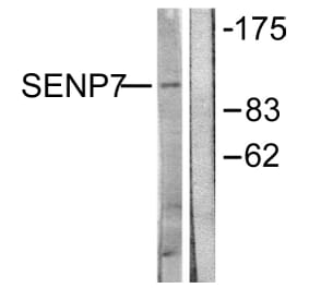 Western Blot - Anti-SENP7 Antibody (C0370) - Antibodies.com