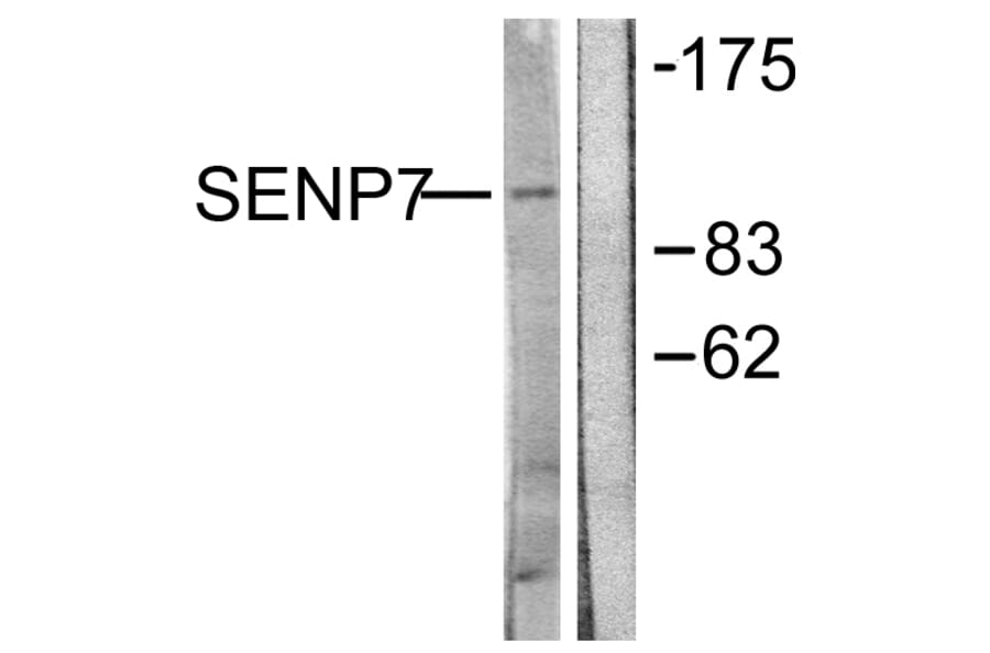 Western Blot - Anti-SENP7 Antibody (C0370) - Antibodies.com