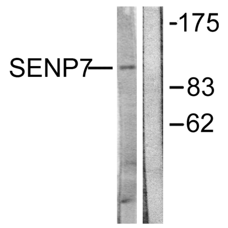 Western Blot - Anti-SENP7 Antibody (C0370) - Antibodies.com