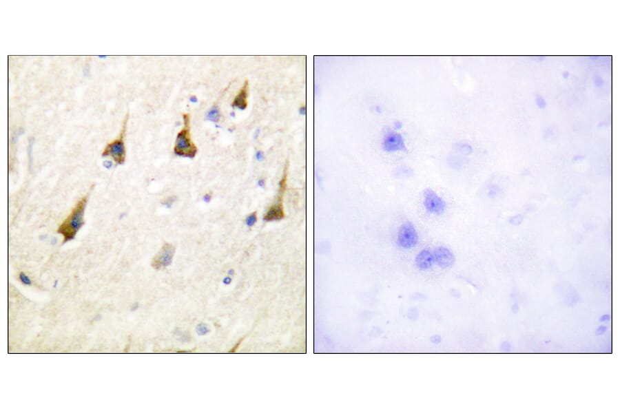 Immunohistochemistry - Anti-SENP7 Antibody (C0370) - Antibodies.com
