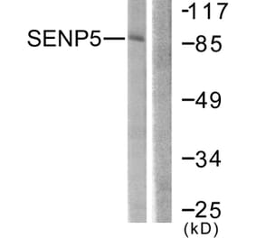 Western Blot - Anti-SENP5 Antibody (C0368) - Antibodies.com