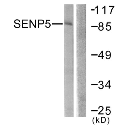 Western Blot - Anti-SENP5 Antibody (C0368) - Antibodies.com