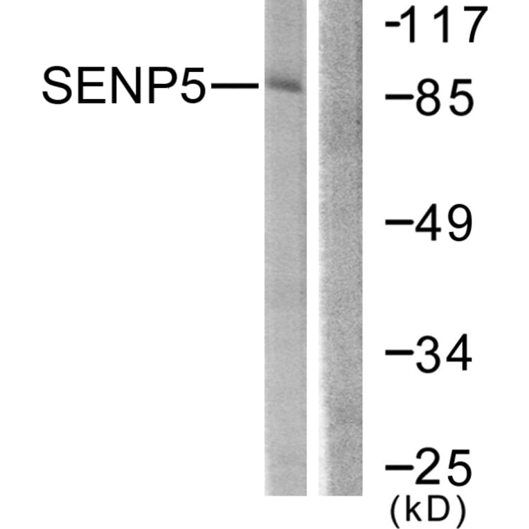 Western Blot - Anti-SENP5 Antibody (C0368) - Antibodies.com