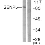 Western Blot - Anti-SENP5 Antibody (C0368) - Antibodies.com