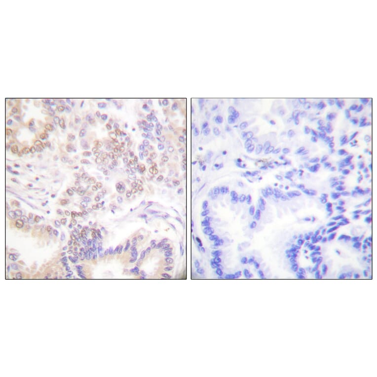 Immunohistochemistry - Anti-SENP5 Antibody (C0368) - Antibodies.com
