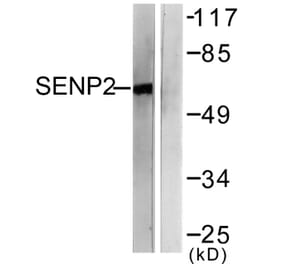 Western Blot - Anti-SENP2 Antibody (C0366) - Antibodies.com