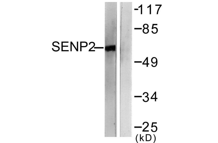 Western Blot - Anti-SENP2 Antibody (C0366) - Antibodies.com