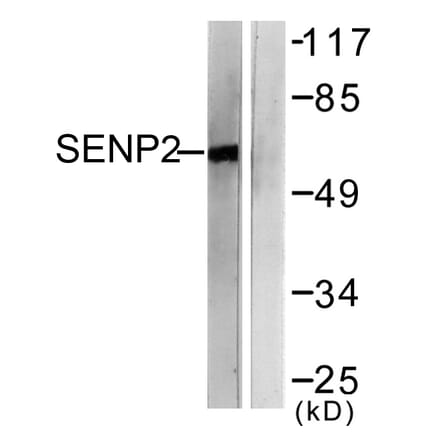 Western Blot - Anti-SENP2 Antibody (C0366) - Antibodies.com
