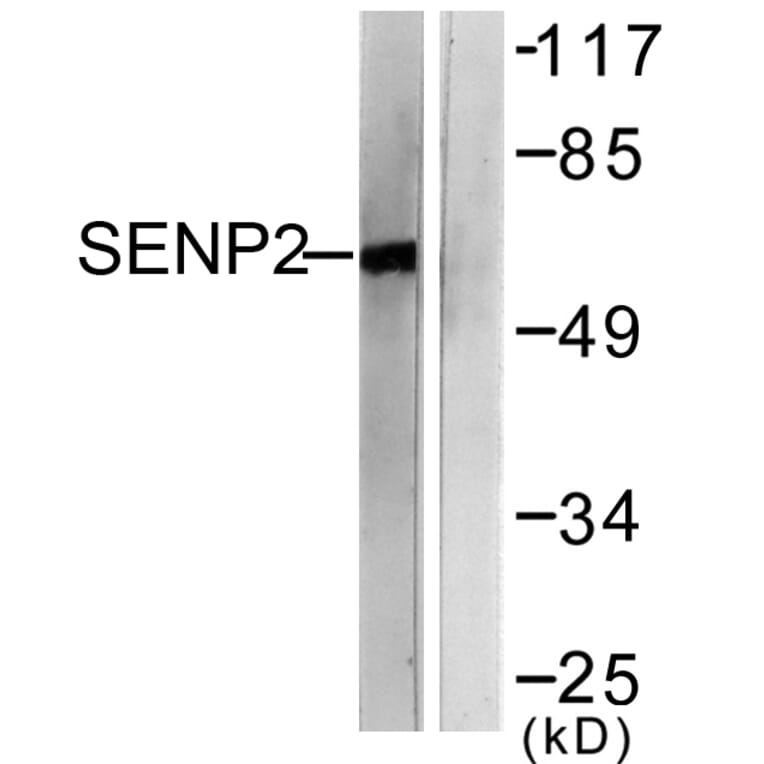 Western Blot - Anti-SENP2 Antibody (C0366) - Antibodies.com