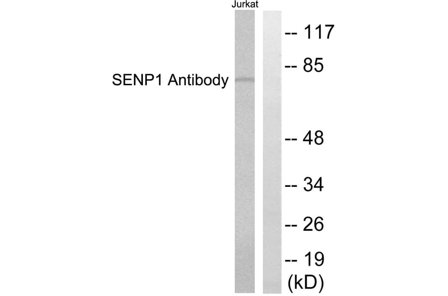 Western Blot - Anti-SENP1 Antibody (C0365) - Antibodies.com