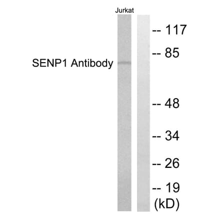 Western Blot - Anti-SENP1 Antibody (C0365) - Antibodies.com