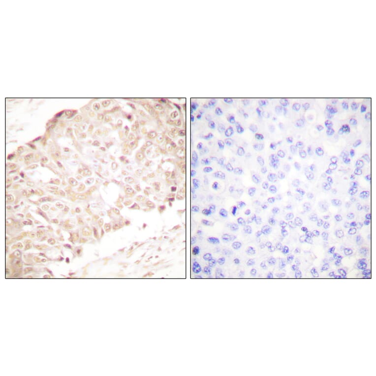 Immunohistochemistry - Anti-SENP1 Antibody (C0365) - Antibodies.com