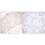 Immunohistochemistry - Anti-SENP1 Antibody (C0365) - Antibodies.com