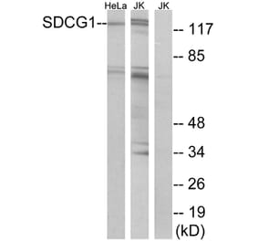 Western Blot - Anti-SDCG1 Antibody (C10140) - Antibodies.com