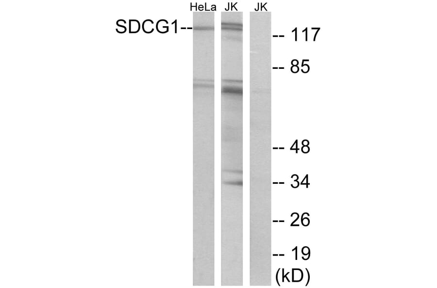 Western Blot - Anti-SDCG1 Antibody (C10140) - Antibodies.com