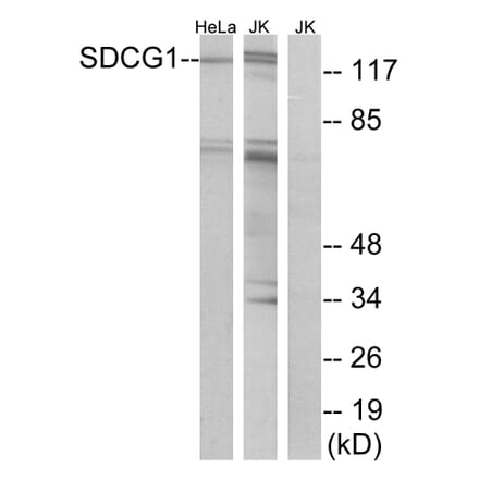 Western Blot - Anti-SDCG1 Antibody (C10140) - Antibodies.com