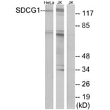 Western Blot - Anti-SDCG1 Antibody (C10140) - Antibodies.com