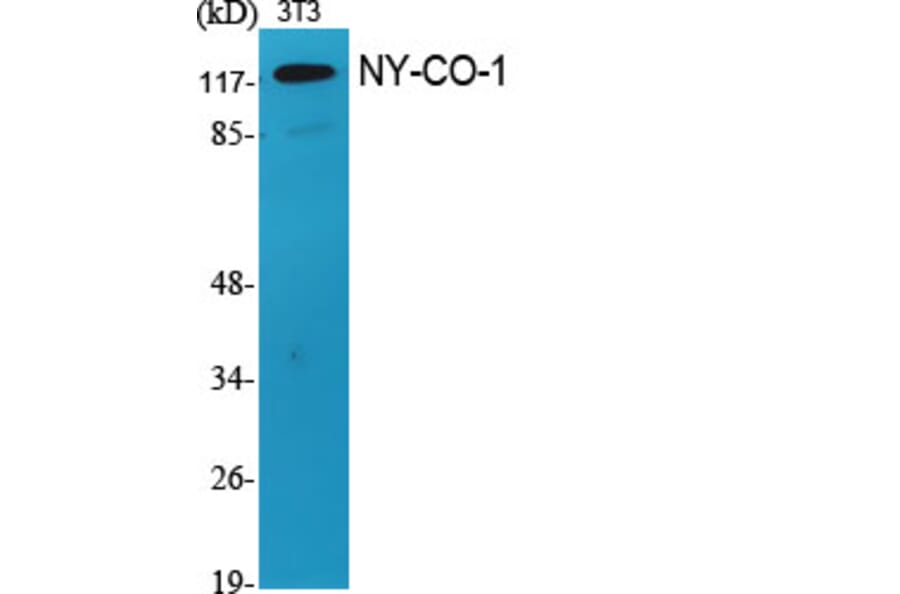 Western Blot - Anti-SDCG1 Antibody (C10140) - Antibodies.com