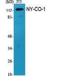Western Blot - Anti-SDCG1 Antibody (C10140) - Antibodies.com