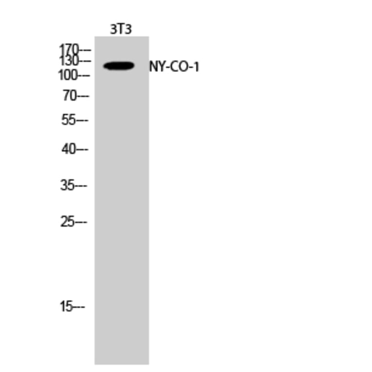 Western Blot - Anti-SDCG1 Antibody (C10140) - Antibodies.com