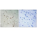 Immunohistochemistry - Anti-SDCG1 Antibody (C10140) - Antibodies.com