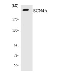 Western Blot - Anti-SCN4A Antibody (R12-3482) - Antibodies.com