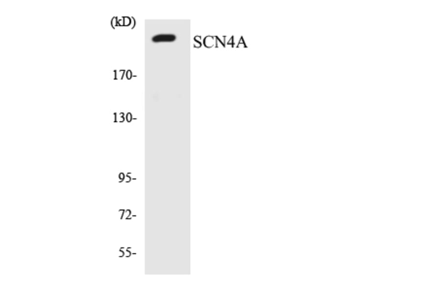 Western Blot - Anti-SCN4A Antibody (R12-3482) - Antibodies.com