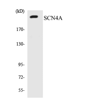 Western Blot - Anti-SCN4A Antibody (R12-3482) - Antibodies.com