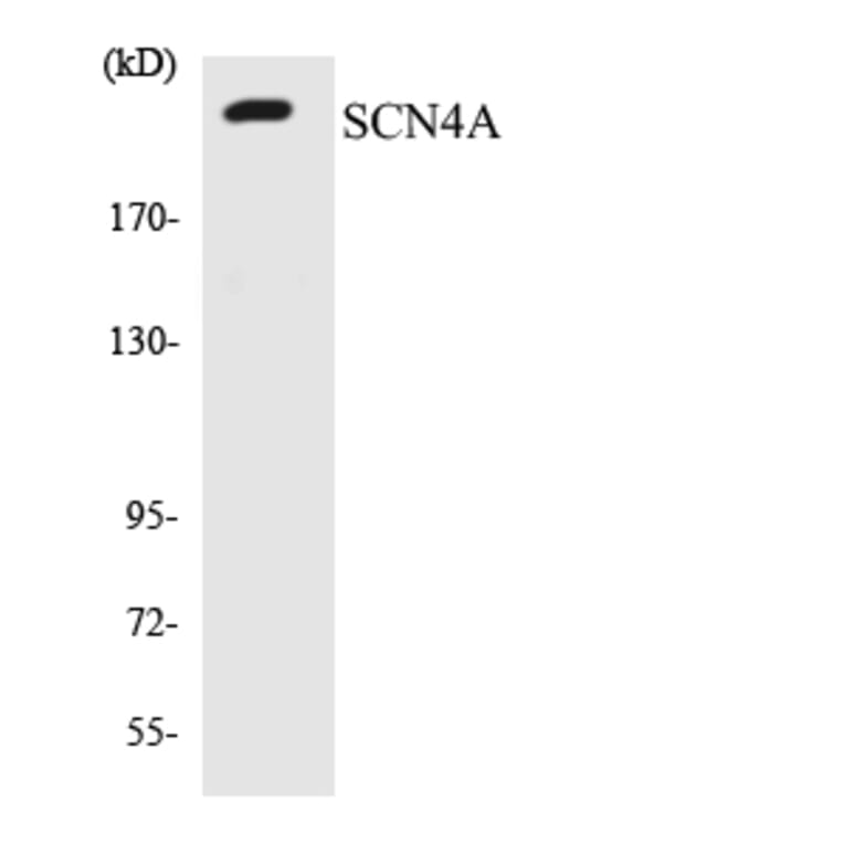 Western Blot - Anti-SCN4A Antibody (R12-3482) - Antibodies.com