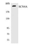 Western Blot - Anti-SCN4A Antibody (R12-3482) - Antibodies.com