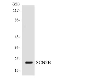 Western Blot - Anti-SCN2B Antibody (R12-3481) - Antibodies.com