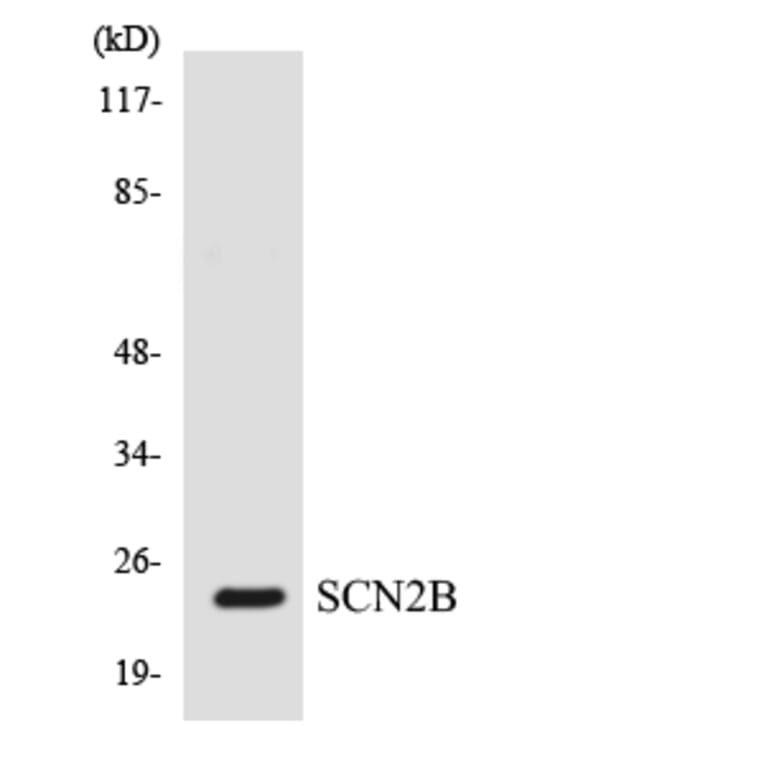 Western Blot - Anti-SCN2B Antibody (R12-3481) - Antibodies.com