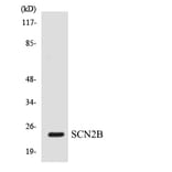 Western Blot - Anti-SCN2B Antibody (R12-3481) - Antibodies.com