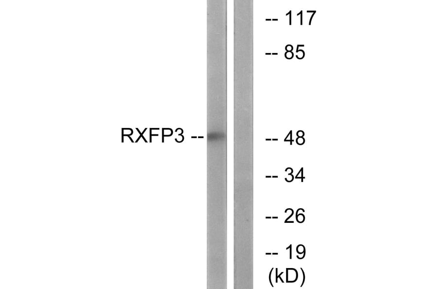 Western Blot - Anti-RXFP3 Antibody (G738) - Antibodies.com