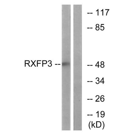 Western Blot - Anti-RXFP3 Antibody (G738) - Antibodies.com