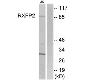 Western Blot - Anti-RXFP2 Antibody (G741) - Antibodies.com