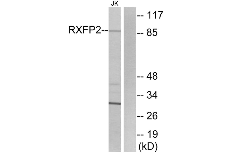 Western Blot - Anti-RXFP2 Antibody (G741) - Antibodies.com