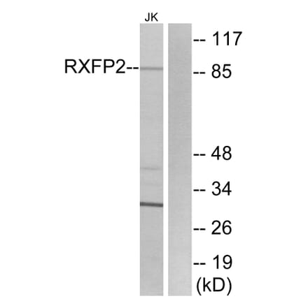 Western Blot - Anti-RXFP2 Antibody (G741) - Antibodies.com