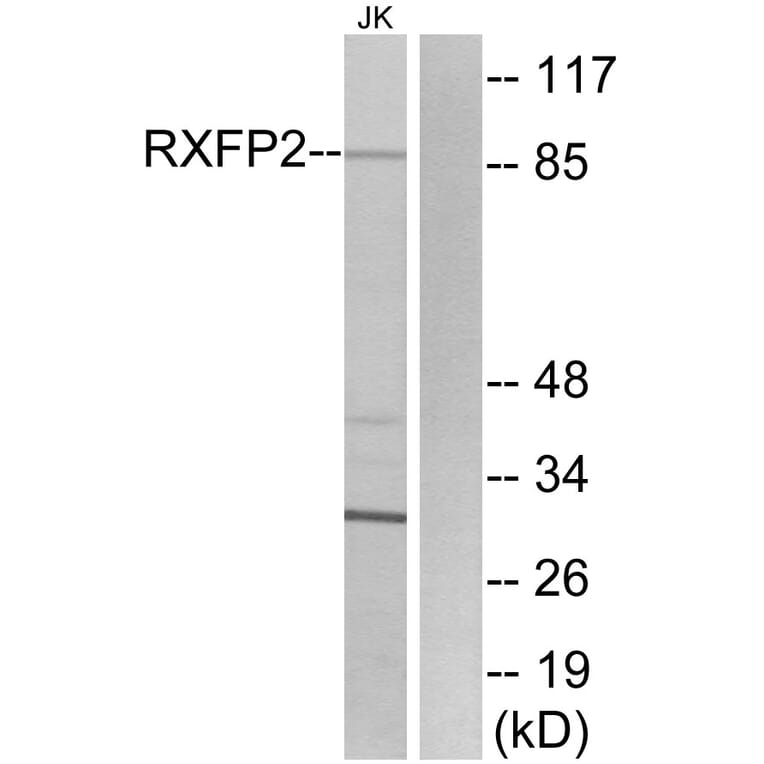Western Blot - Anti-RXFP2 Antibody (G741) - Antibodies.com