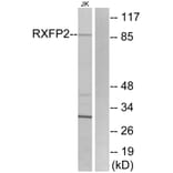 Western Blot - Anti-RXFP2 Antibody (G741) - Antibodies.com
