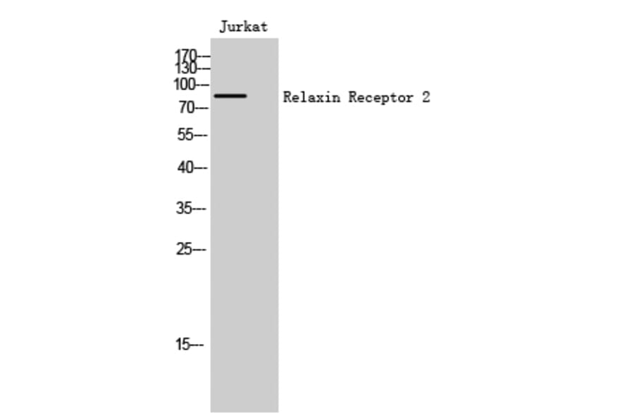 Western Blot - Anti-RXFP2 Antibody (G741) - Antibodies.com