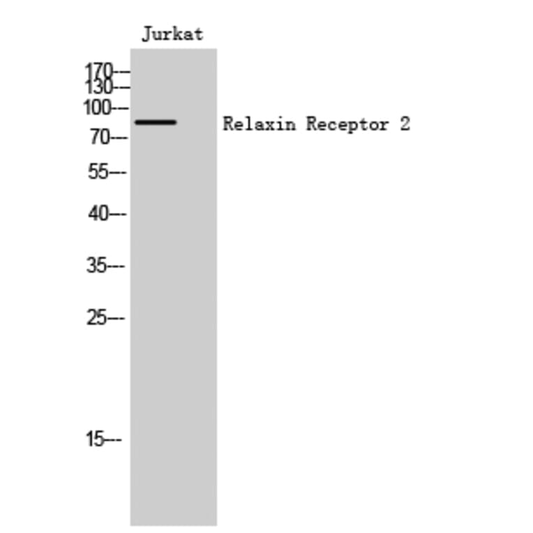 Western Blot - Anti-RXFP2 Antibody (G741) - Antibodies.com