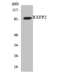 Western Blot - Anti-RXFP2 Antibody (R12-3472) - Antibodies.com