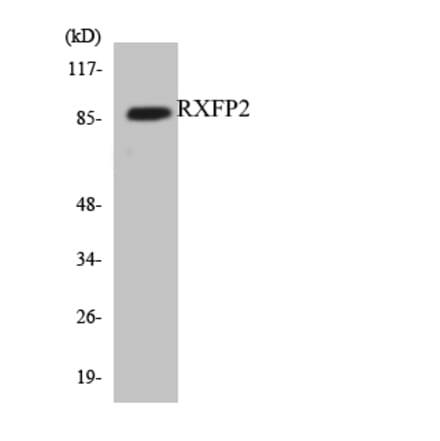 Western Blot - Anti-RXFP2 Antibody (R12-3472) - Antibodies.com