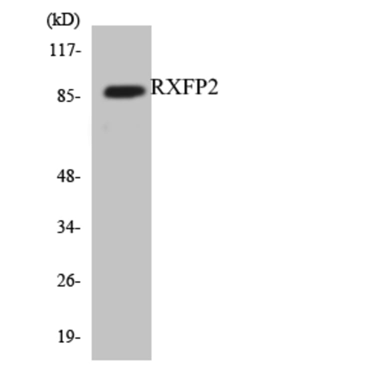 Western Blot - Anti-RXFP2 Antibody (R12-3472) - Antibodies.com