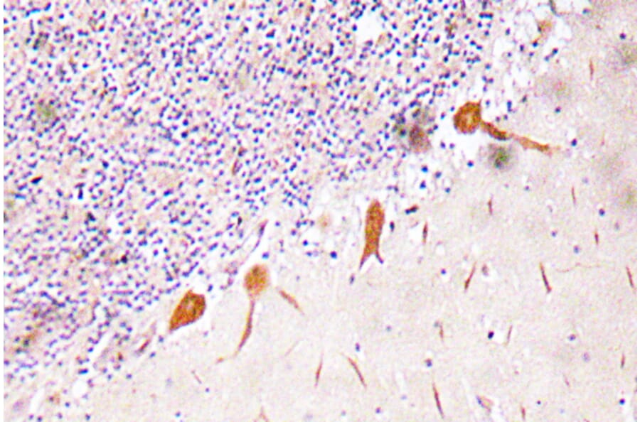 Immunohistochemistry - Anti-RUNX2 Antibody (R12-2340) - Antibodies.com