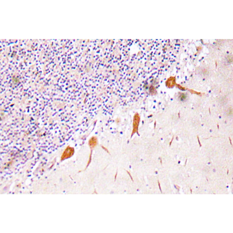 Immunohistochemistry - Anti-RUNX2 Antibody (R12-2340) - Antibodies.com