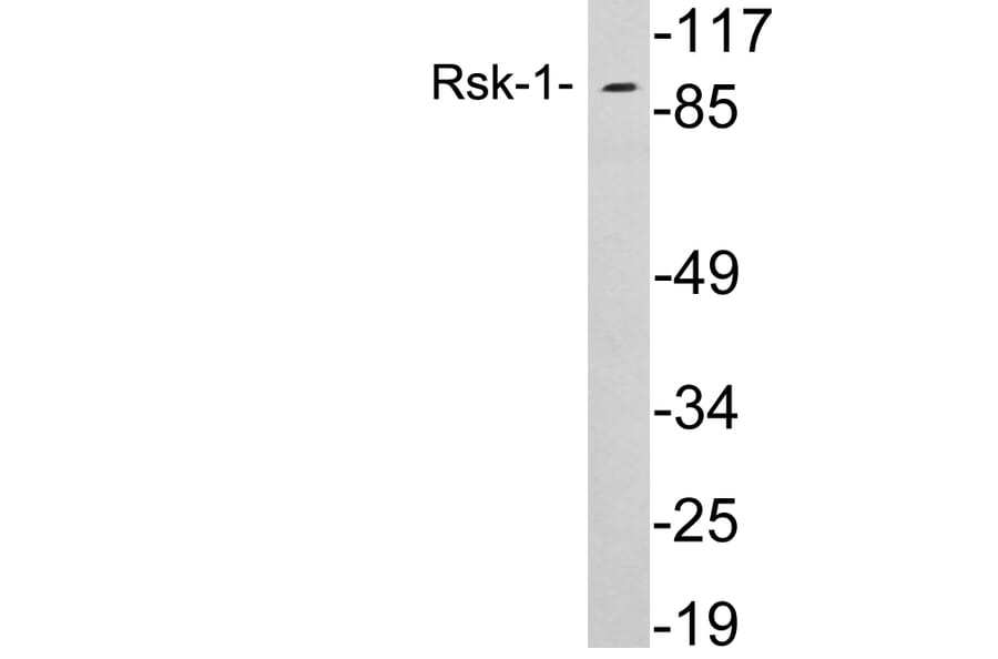 Western Blot - Anti-Rsk-1 Antibody (R12-2338) - Antibodies.com
