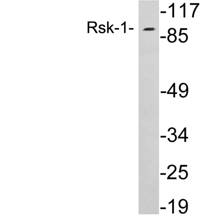 Western Blot - Anti-Rsk-1 Antibody (R12-2338) - Antibodies.com