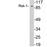 Western Blot - Anti-Rsk-1 Antibody (R12-2338) - Antibodies.com